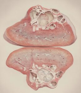 a drawing of two sections of a heart