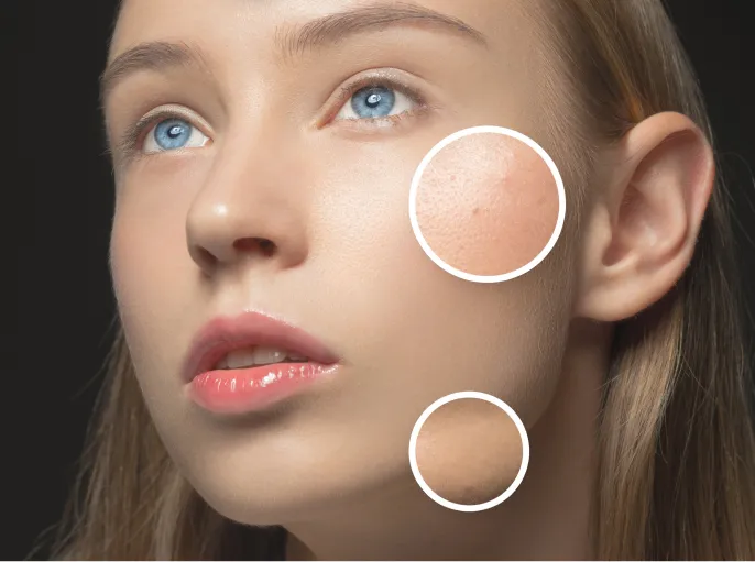 beautiful girl with various types of skin close up utc