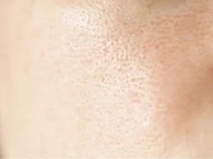 close-up-of-a-face-showing-skin-detail-2026-03-13-01-48-50-utc