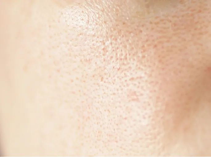 close-up-of-a-face-showing-skin-detail-2026-03-13-01-48-50-utc