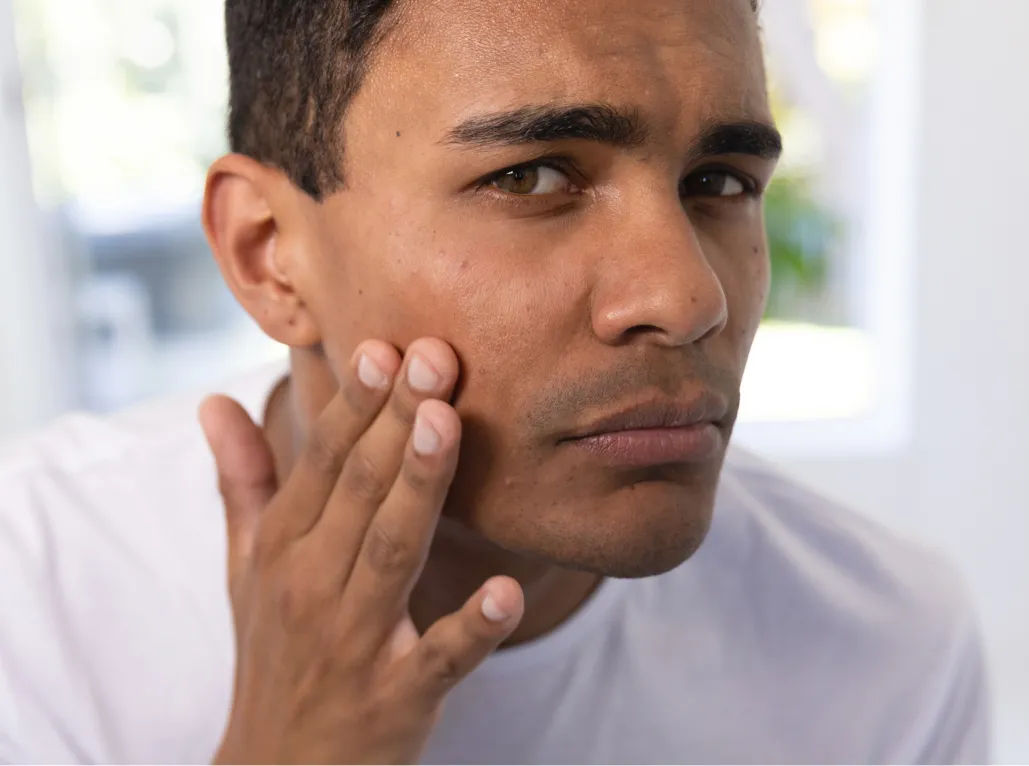 Man applying lotion to his cheek